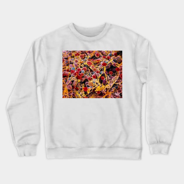 Coloured SEM of adipose tissue showing fat cells (P760/0014) Crewneck Sweatshirt by SciencePhoto